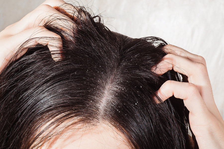 A healthy scalp leads to healthy hair !